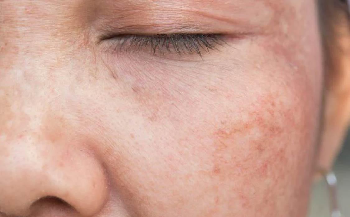 BioCare Premium Glutathione Brightening Gummies