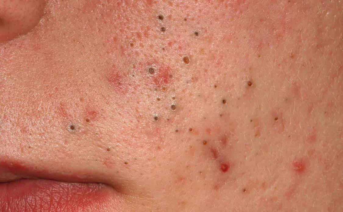 SkinClinic Clay Pure Mask