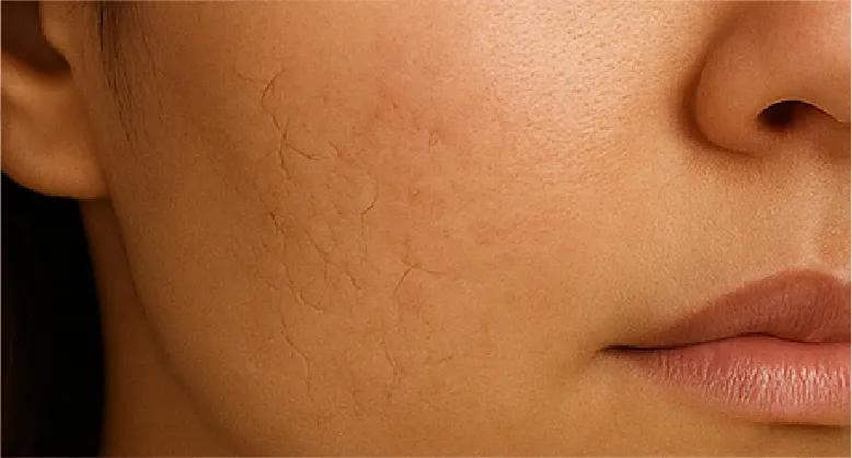 BioCare Handmade Hyaluronic Acid Moisturizing Beauty Bar