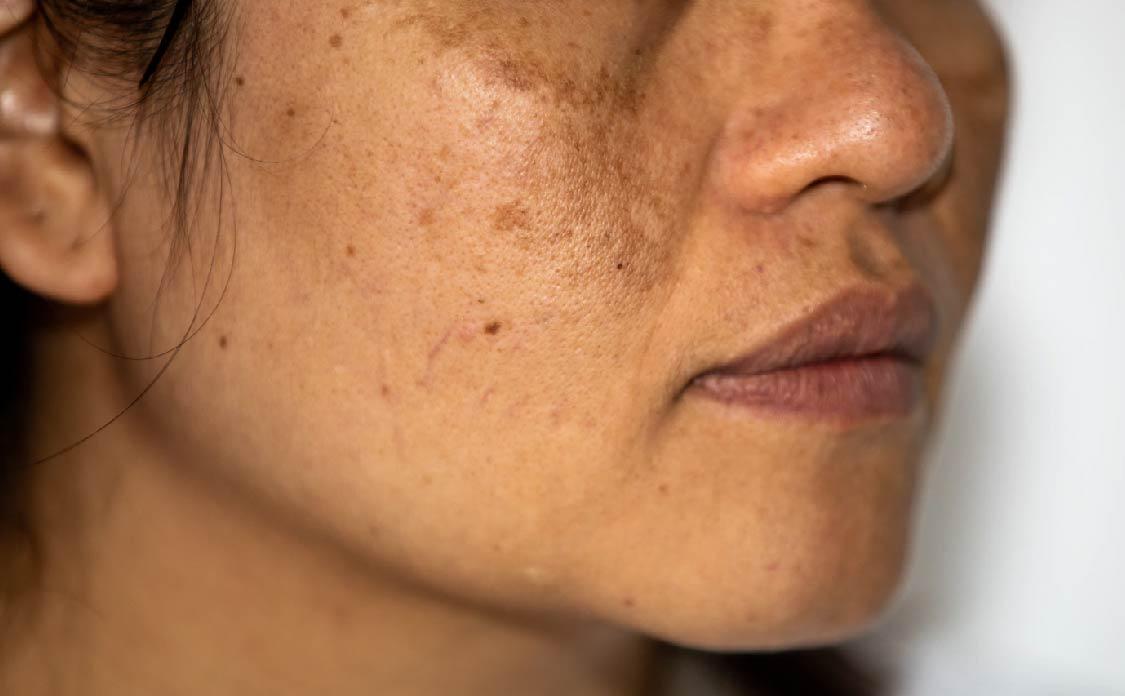 Novaclear Advanced Dark Spot Correcting Cream SPF 50