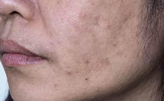 BioCare Exfoliating Face Serum