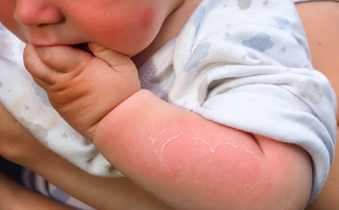 Dermedic Sunbrella BABY Sun Protection Cream